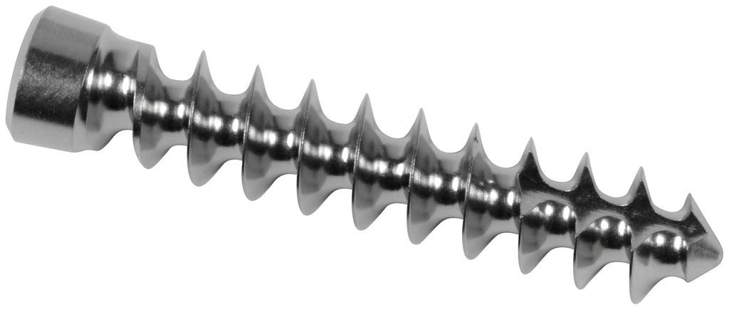 医療従事者確認 | プレート & スクリュー | Knee | Arthrex