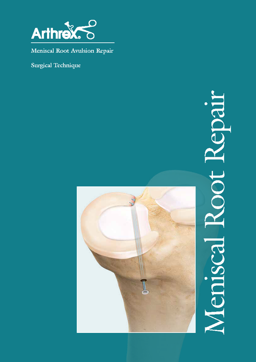 【LT7-00108-JA_A】Meniscal Root Repair 手技書