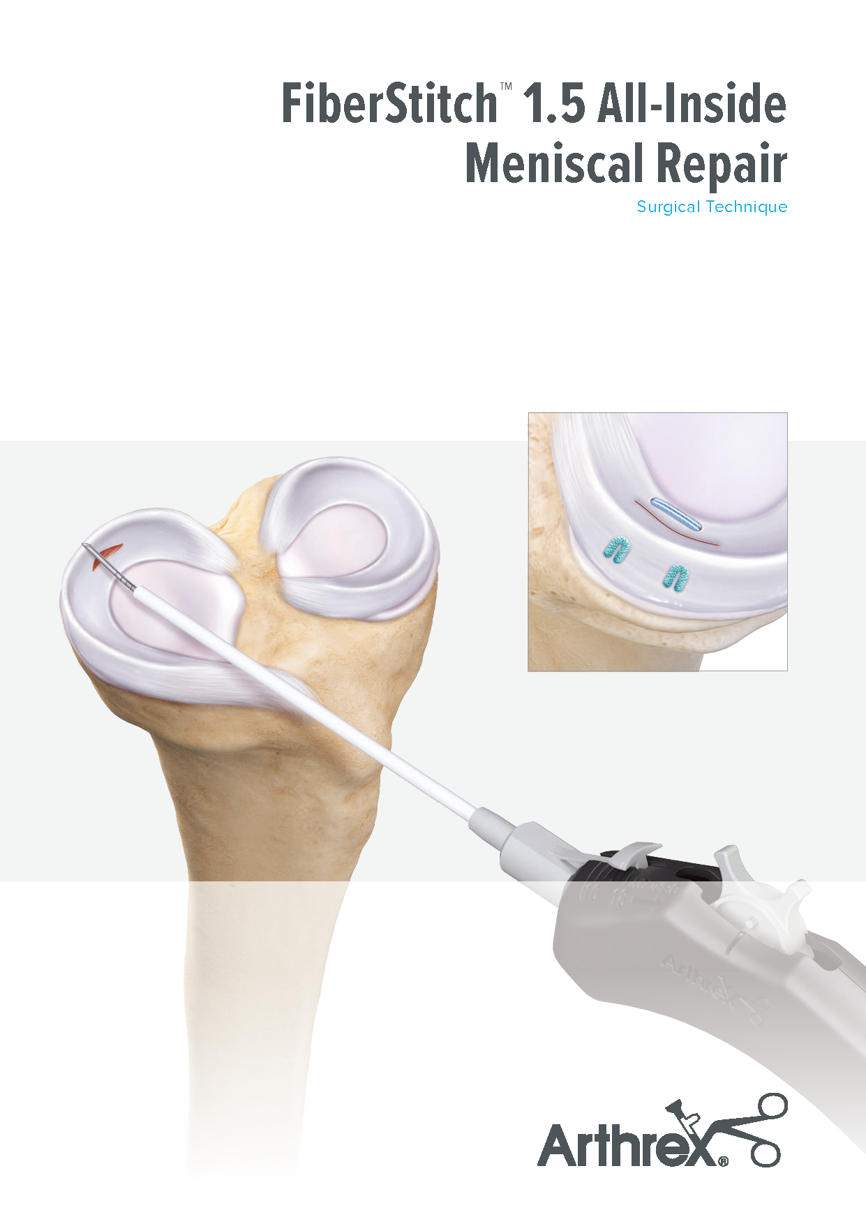 療術の原理と方法　手技編 改訂第2版 外傷処置・小手技の技&Tips−はやく,要領よく