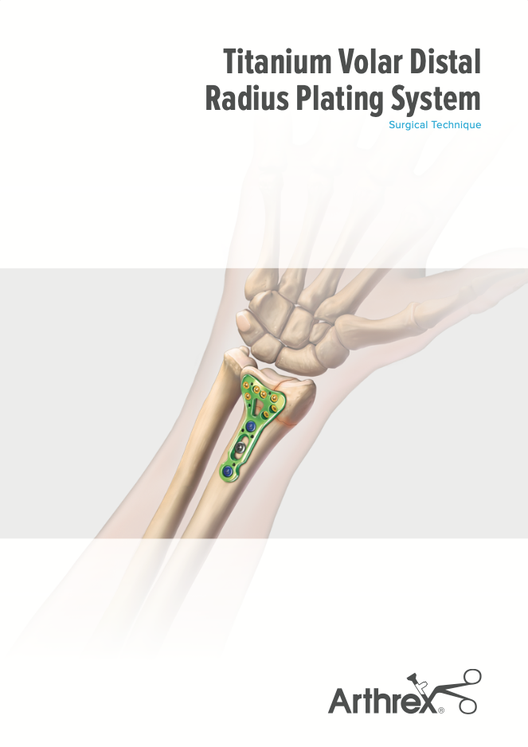 LT7-0416-ja-JP_A_Titanium Volar Distal Radius Plating System Surgical Technique