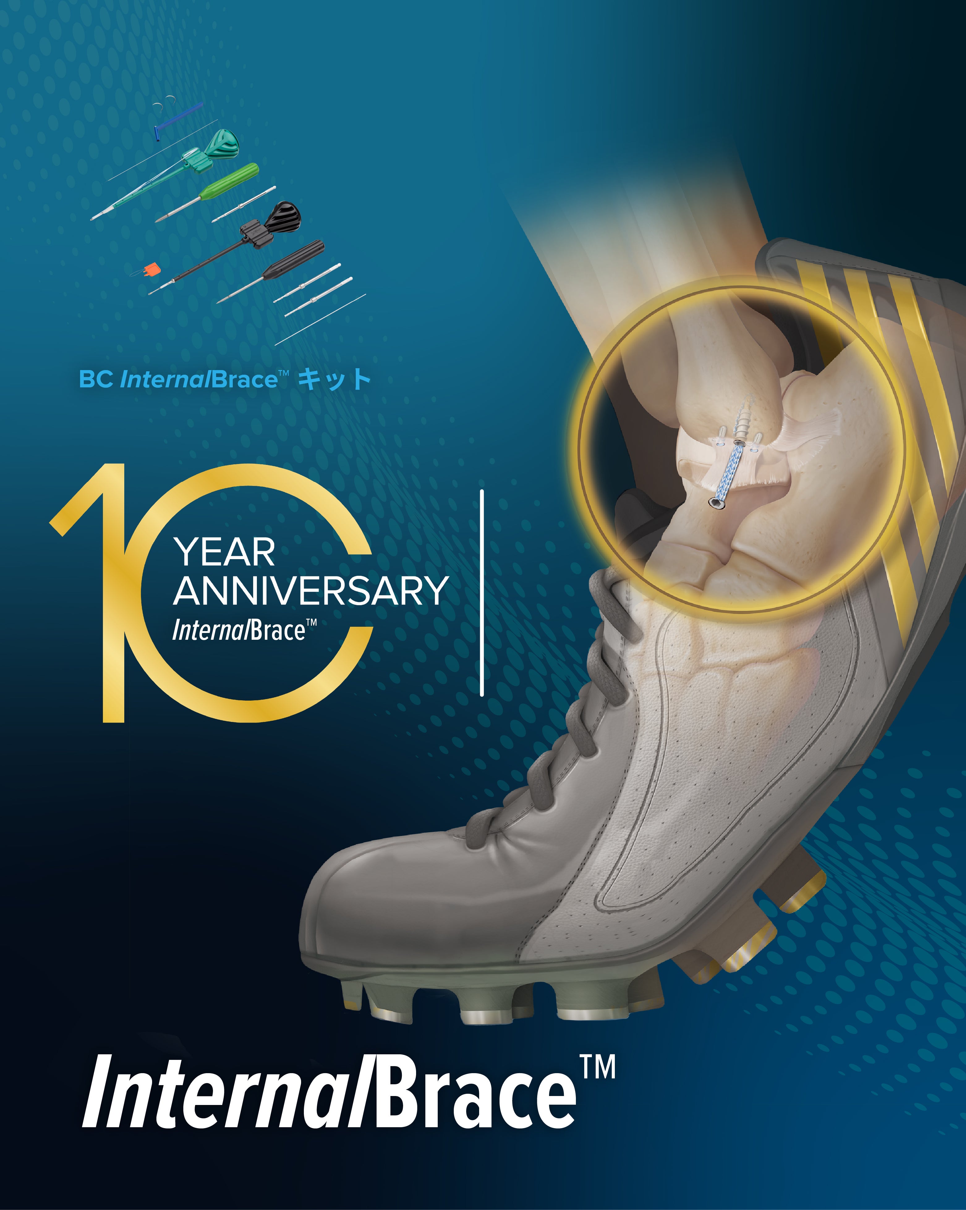 Arthrex Foot&Ankle Solutions | Arthrex
